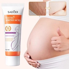 40g Scar Removal Cream for Old-Scars Stretch Mark Removal Cream Rapid Repair  