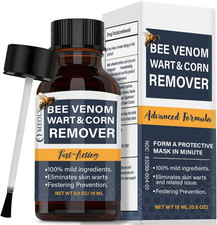 Bee Venom Skin Wart Remover: Fast-Acting 20 Salicylic Acid Skin Wart Remover fo