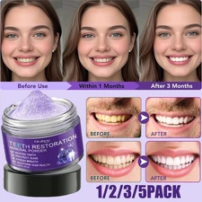 1-5pcs Dental restoration mineral powder, mineral tooth powder, teeth whitening