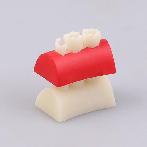 Dental Inlay Exercise Model Block Filling Exercise For Dentistry Teaching Stud - Picture 7 of 12