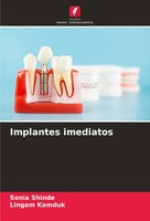 Sonia Shinde (U. A.) | Implantes Imediatos | Taschenbuch | Portugiesisch (2025)