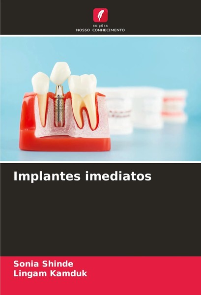 Sonia Shinde (U. A.) | Implantes Imediatos | Taschenbuch | Portugiesisch (2025)-image