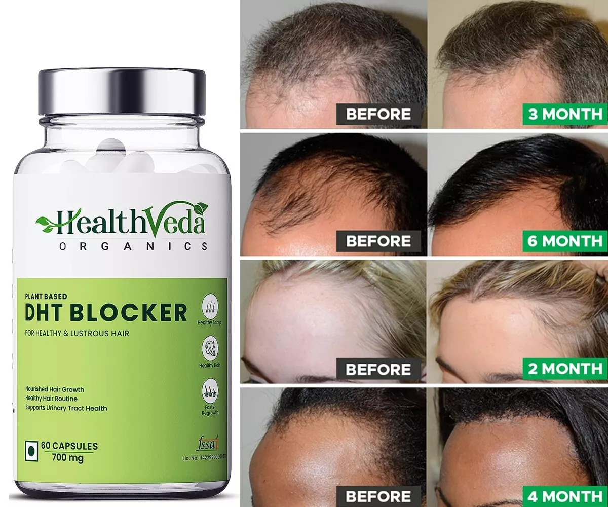 DHT Blocker Supplement for Women and Men Support Thicker