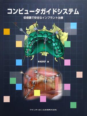 Computer-guided system: Minimally invasive implant treatment