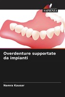 Namra Kausar | Overdenture Supportate Da Impianti | Taschenbuch | Italienisch