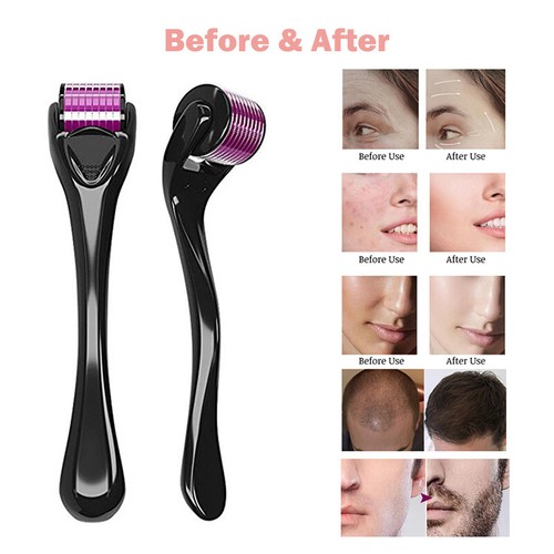 Rullo derma barba per perdita capelli crescita barba titanio rullo derma micro - Foto 10 di 12