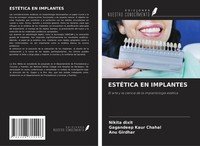 EstÉTica EN Implantes Nikita Dixit