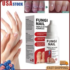 Fungi-Nail Anti-Fungal Liquid Solution Kills Fungus That Can Lead To Nail