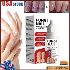 Fungi-Nail Anti-Fungal Liquid Solution Kills Fungus That Can Lead To Nail