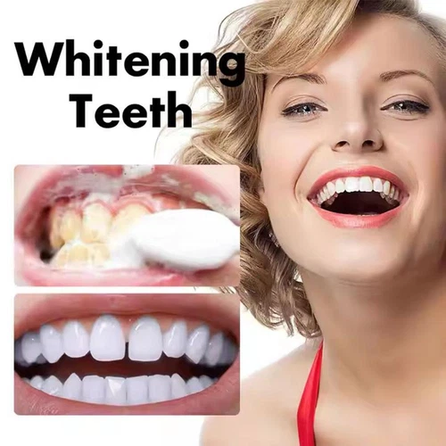 5/3 Pack UTOGRU Whitening Toothpaste Niacinamide Dazzling Whitening Toothpastes - Imagen 5 de 20