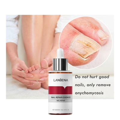 LANBENA Nail Repair Essence Remove Onychomycosis Serum Fungal Nail Treatment