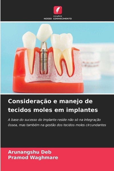 ConsideraçãO E Manejo De Tecidos Moles Em Implantes Arunangshu Deb-image