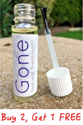 GONE - HYPERPIGMENTATION - Natural Pigmentation Removal Treatment Cream Serum