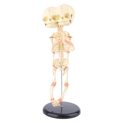 Human Baby Deformed for Head Skull Research Model Skeleton Anatomical Brain Anat