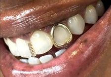 Custom Fit 14K Gold Plated Mouth Teeth Open Face Tooth Cap + Iced Gap Grillz Set