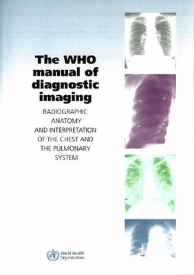 The WHO Manual of Diagnostic Imaging: Radiographic Anatomy and Interpretation of