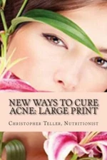 New Ways To Cure Acne: Large Print: Skin Care Acne Home Remedies And Treatm...