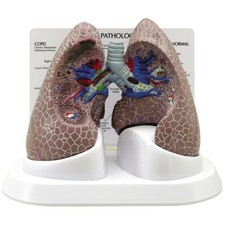 COPD Lung Disease Anatomical Model GPI LFA 3110 SEE VIDEO Make Us an Offer