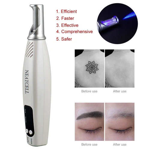 Penna laser professionale picosecondi blu e rossa rimozione tatuaggi acne talpa cicatrici detergente - Foto 5 di 17
