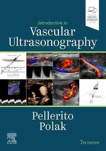 Thumbnail - Joseph F. Polak John Introduction To Vascular Ul (gebundene Ausgabe)