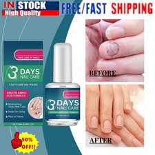3 DAYS Nail Care Oil, 10ml, Keratin & Amino Acid Formula, Nail Repair NEW