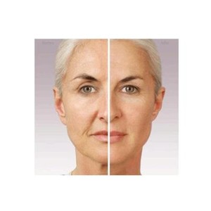 combination skin gel moisturizer