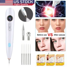 Electric Laser Plasma Pen Mole Removal Dark Spot Remover Skin Wart Tag Tattoo