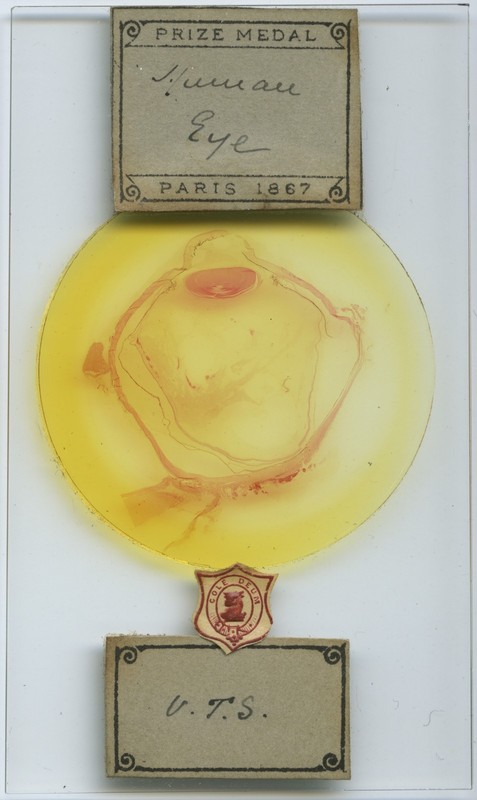 Antique Microscope Slide by Cole - Human Eye VTS Oversized