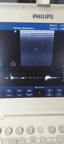 Philips L12-3 compact ultrasound Transducer / Probe Epiq CX50 Affiniti - Picture 4 of 4