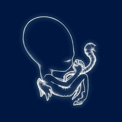 Agaetis Byrjun by Sigur Ros (Record, 2021)