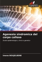 Agenesia Sindromica Del Corpo Calloso Studio Epidemiologico, Clinico E Genetico