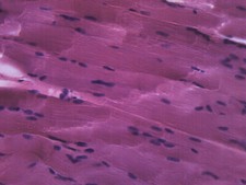 Skeletal Muscle, Mammal - Prepared Microscope Slide - 75x25mm - Eisco Labs