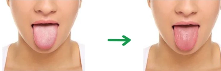 2x Ayurveda 100% Kupfer Zungenschaber, Zungenreiniger Zungenbelag Mundhygiene - Bild 4 von 4