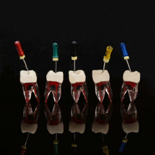 Dental Tooth Endo Root Canal Study Model For RCT Practice Blocks Pulp Cavity - Picture 3 of 8