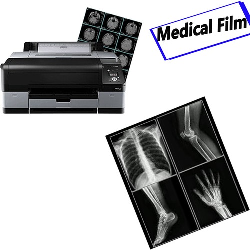 11x17,Screen Printing Waterproof Instant Dry Inkjet Transparency Film,50 Sheets - Picture 9 of 12
