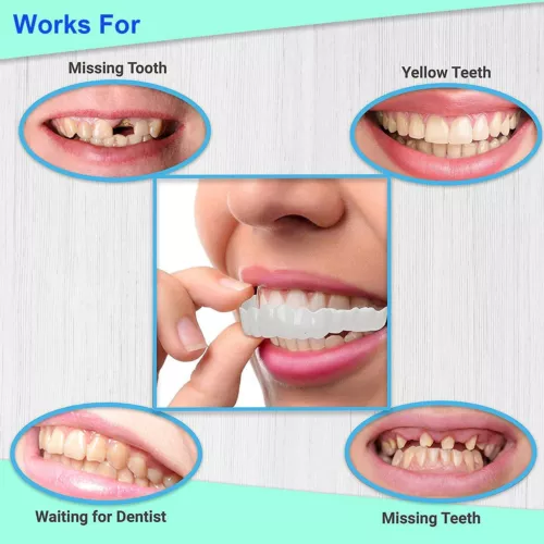 Set superiore e inferiore a scatto denti finti faccette dentali protesi copertura denti US - Foto 8 di 12