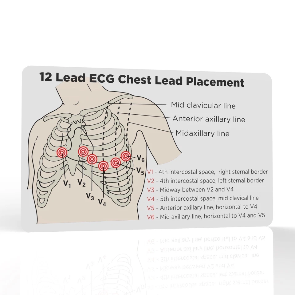 THE PRINT NINJA 12 Lead ECG Placement Reference Card Student Paramedic Nurse Doctor Medic