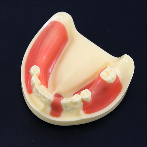 Multiple Types Dental Teeth Model Ortho Implant Practice Teaching Demo Model - Picture 202 of 276
