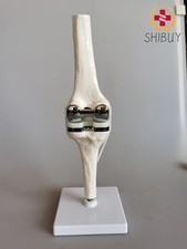 Modelo de exhibición de demostración de esqueleto anatómico médico articulación de rodilla artificial 1:1