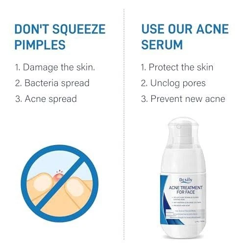 Tratamiento de acné facial Dcsily 1,7 fl oz - ácido salicílico - aceite de árbol de té - aloe Foto 3 de 4