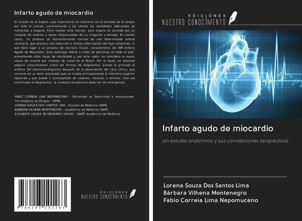 Lorena Souza Dos Santos Lima (U. A.) | Infarto Agudo De Miocardio | Taschenbuch-image