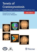 Tenets Of Craniosynostosis | Deepak Gupta (U. A.) | Buch | Deutsch | 2019