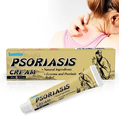 NICHT MARKENGEBUNDEN Neu Psoriasis Creme Natural Ingredients Für Dermatitis Eczema Psoriasis Relief
