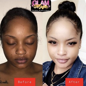 under eye bleaching cream