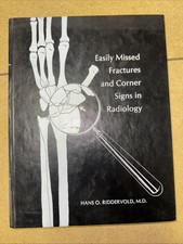 EASILY MISSED FRACTURES AND CORNER SIGNS IN R...