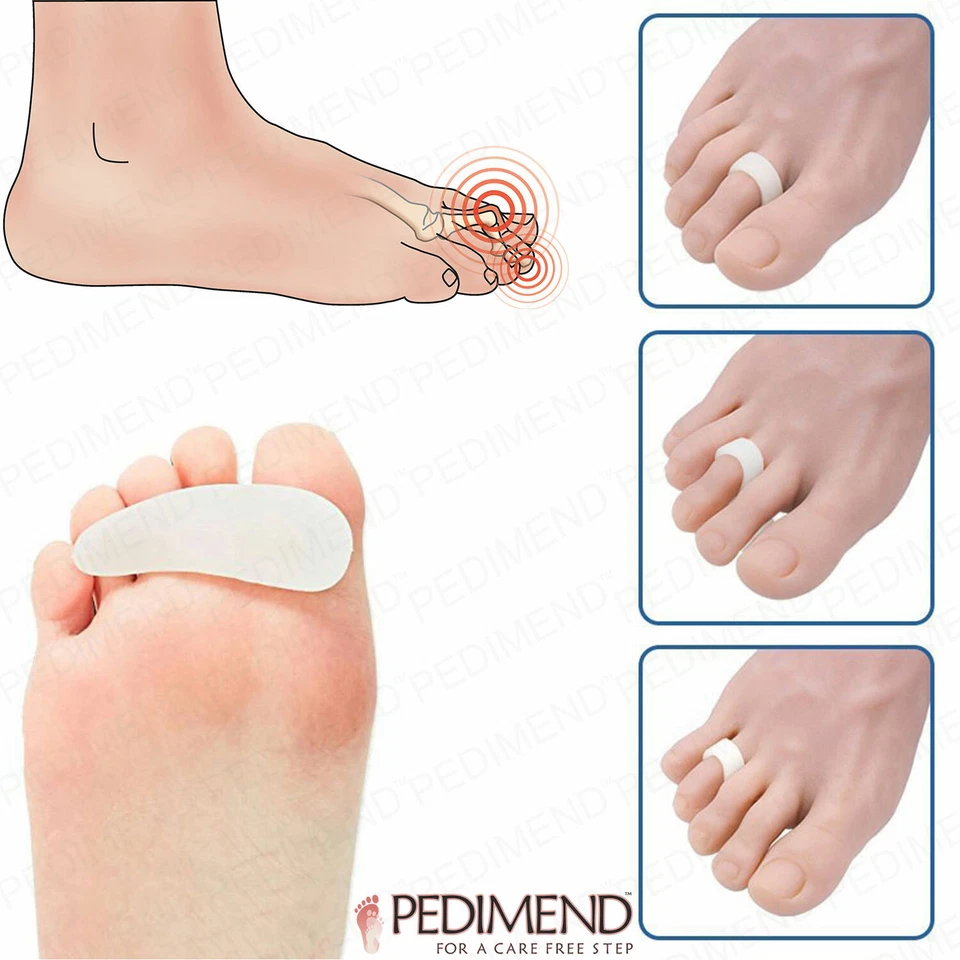 PEDIMEND™ Gel Hammer Toe Crest Pads (Single + Triple) Loop for Overlapping Toes - Image 3 of 4