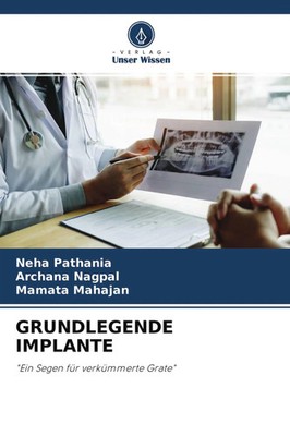 GRUNDLEGENDE IMPLANTE Ein Segen für verkümmerte Grate Neha Pathania (u. a.) Buch