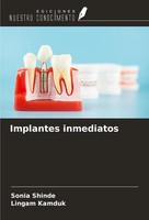Sonia Shinde (U. A.) | Implantes Inmediatos | Taschenbuch | Spanisch (2025)
