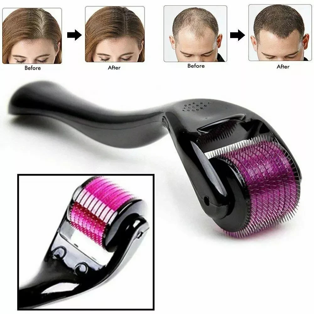1.0mm Size 540 Microneedle Scar Derma Roller For Facial Skin Care