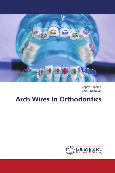 Jophy Prince A (U. A.) | Arch Wires In Orthodontics | Taschenbuch | Englisch-image